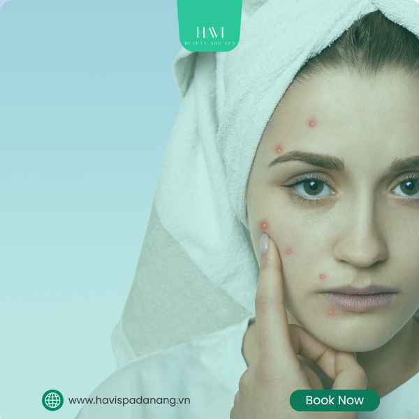 Facial for Oily Skin at HAVI Spa Da Nang