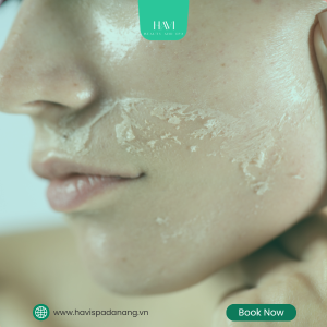 Sensitive Skin Facial at HAVI Spa Da Nang