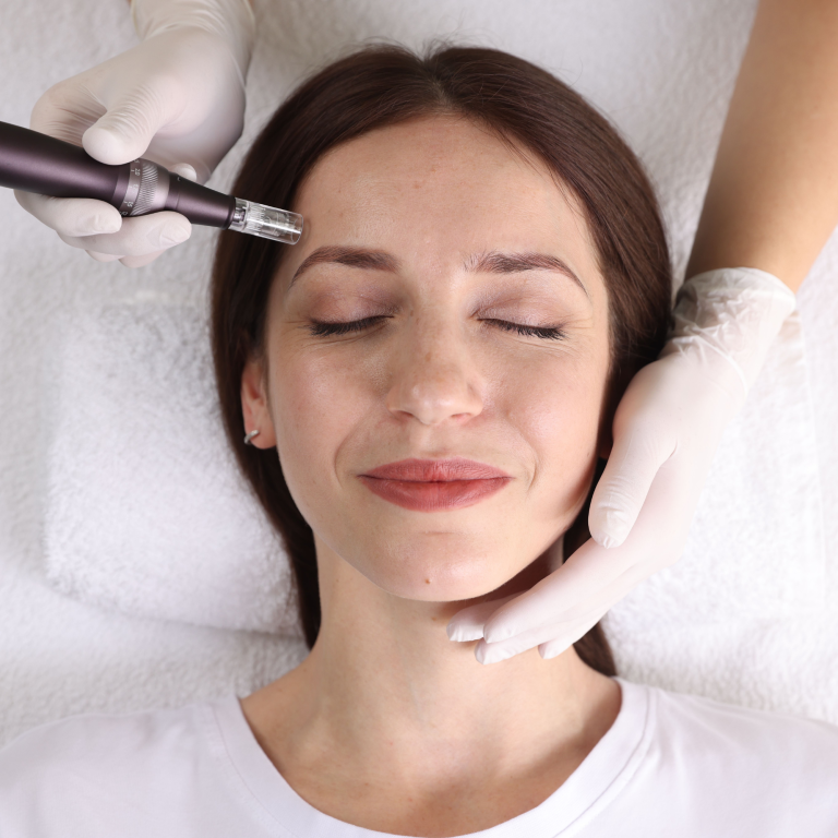 Stem Cell Microneedling Facial